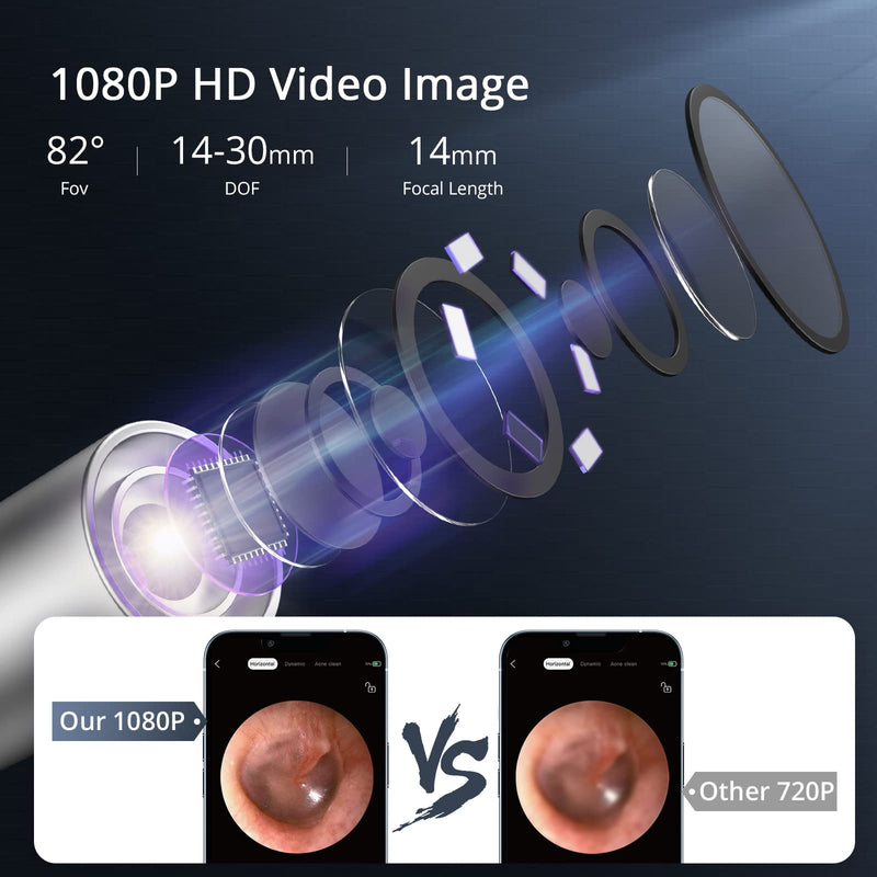 GAOMON Ear Wax Removal EV1 with 1080P HD Ear Camera Ear Cleaner