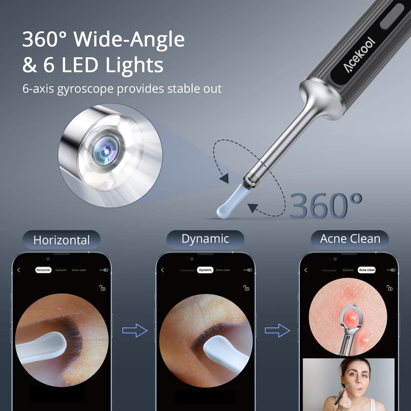GAOMON Ear Wax Removal EV1 with 1080P HD Ear Camera Ear Cleaner