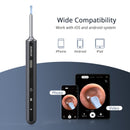 GAOMON Ear Wax Removal EV1 with 1080P HD Ear Camera Ear Cleaner