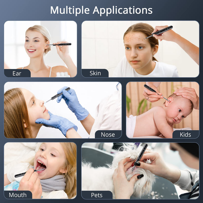 GAOMON Ear Wax Removal EV1 with 1080P HD Ear Camera Ear Cleaner